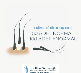 Shedding 50 hair shaft in a day is normal, but 100 hairs is abnormal