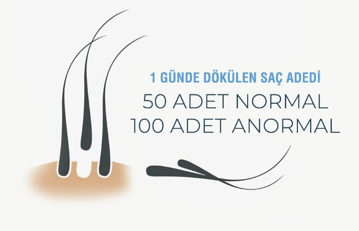 Shedding 50 hair shaft in a day is normal, but 100 hairs is abnormal