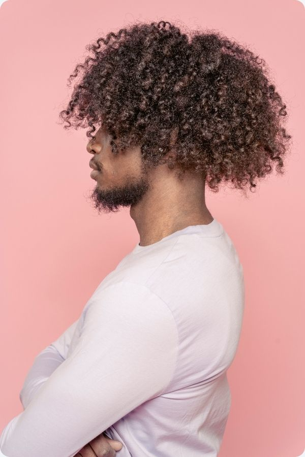 AFRO-AMERICAN HAIR TRANSPLANT