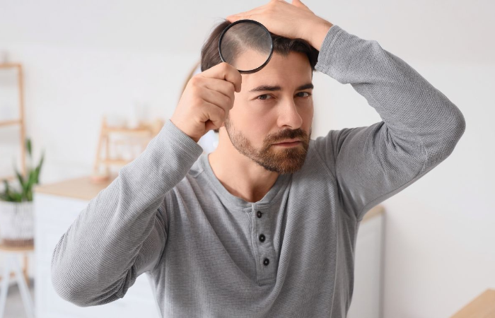 Repair/Revisions of the Ineffectual Hair Transplantations 