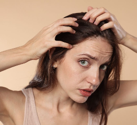 Causes Of Hair Loss in Females 