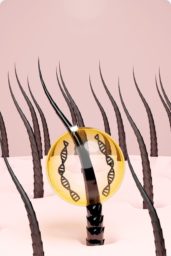 HAIR TRANSPLANTATION IN WOMEN