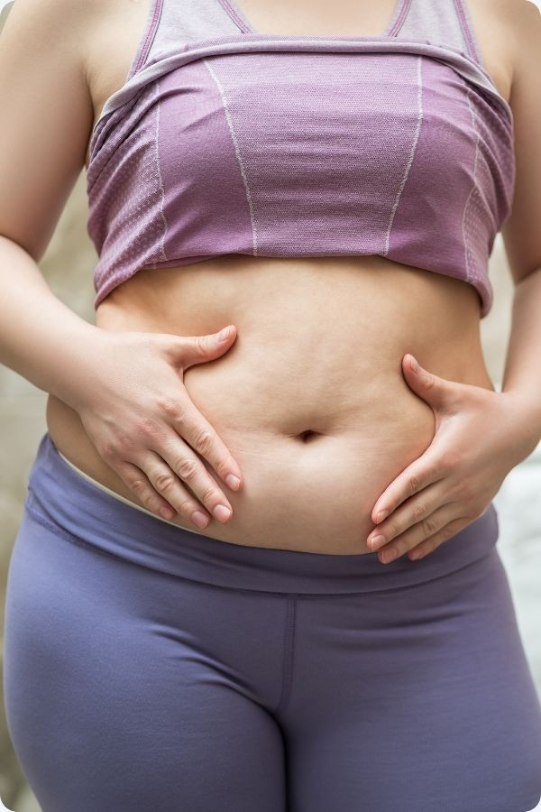 TUMMY TUCK