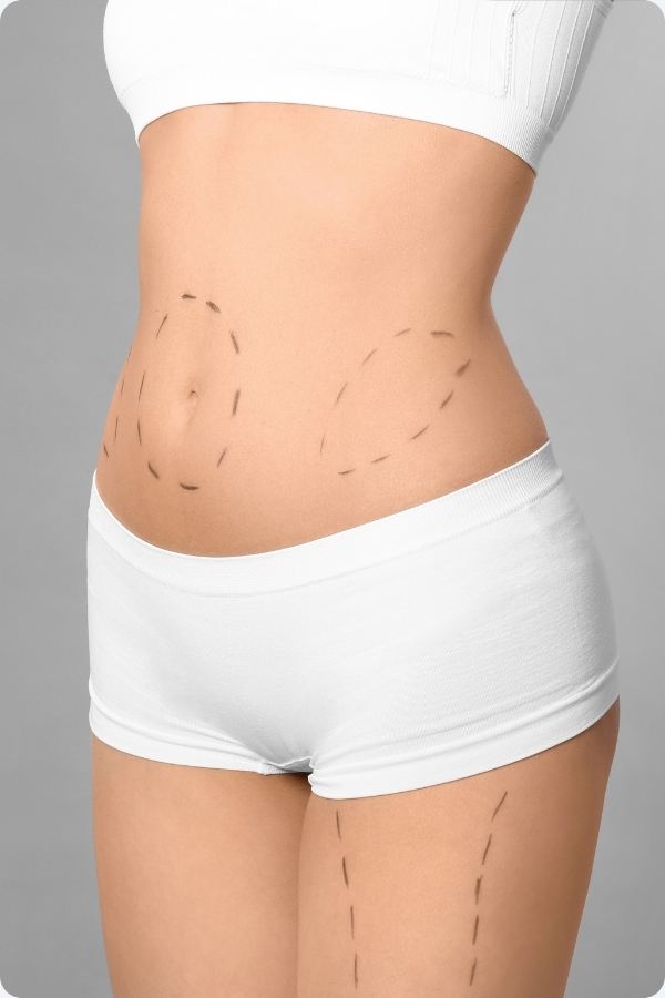 BODY SHAPING