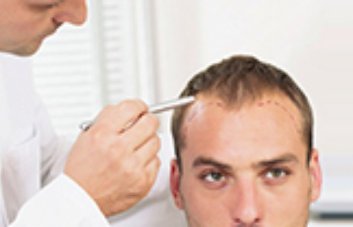 Where Should I have a Hair Transplant or Hair Restoration Surgery