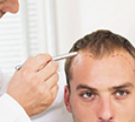 Where Should I have a Hair Transplant or Hair Restoration Surgery