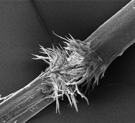 Trichorrhexis Nodosa Nedir?